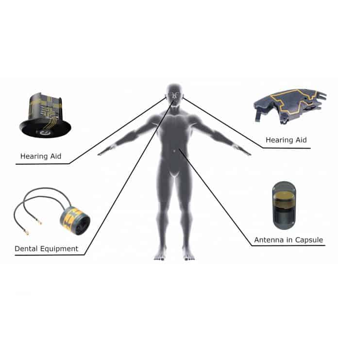 La tecnologia 3D-MID permette di realizzare sensori high-tech che possono essere inseriti all’interno del corpo del paziente